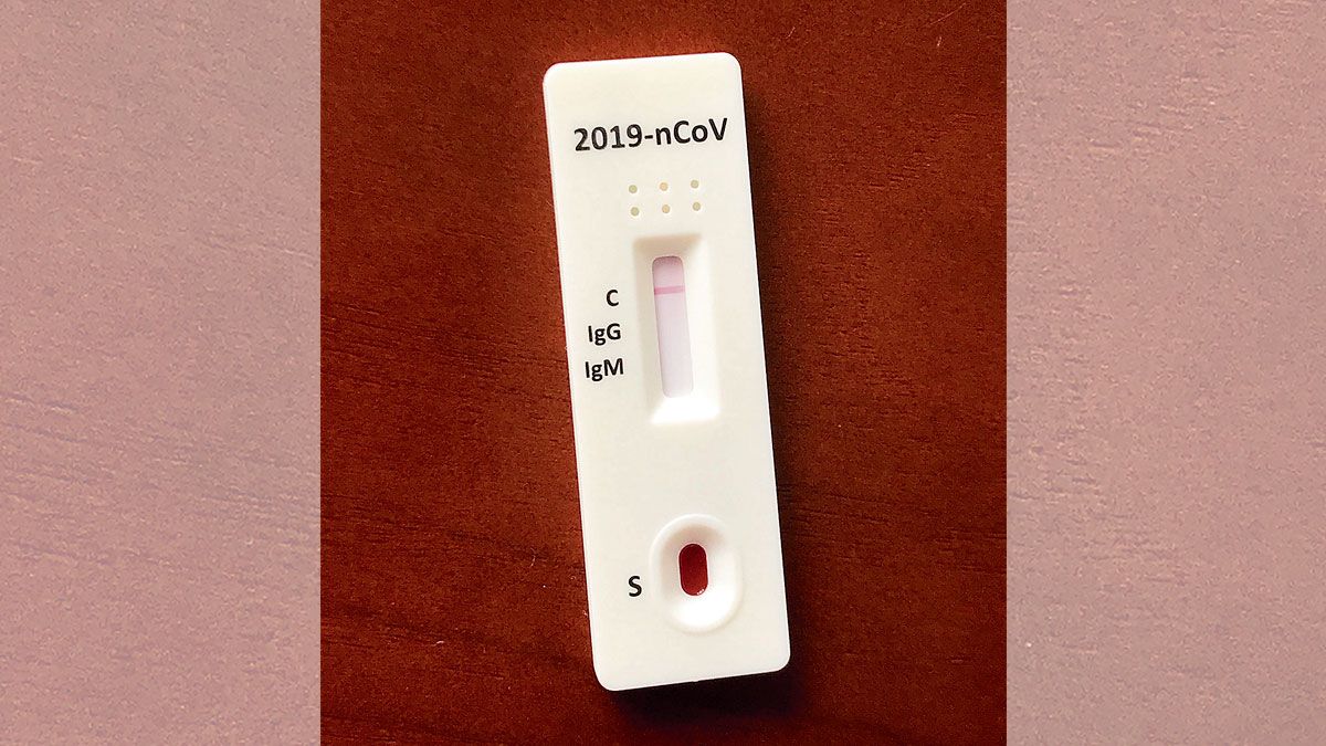 Imagen de los test rápidos con los que se trabaja en León. | J.C. Imagen de los test rápidos con los que se trabaja en León. | J.C.