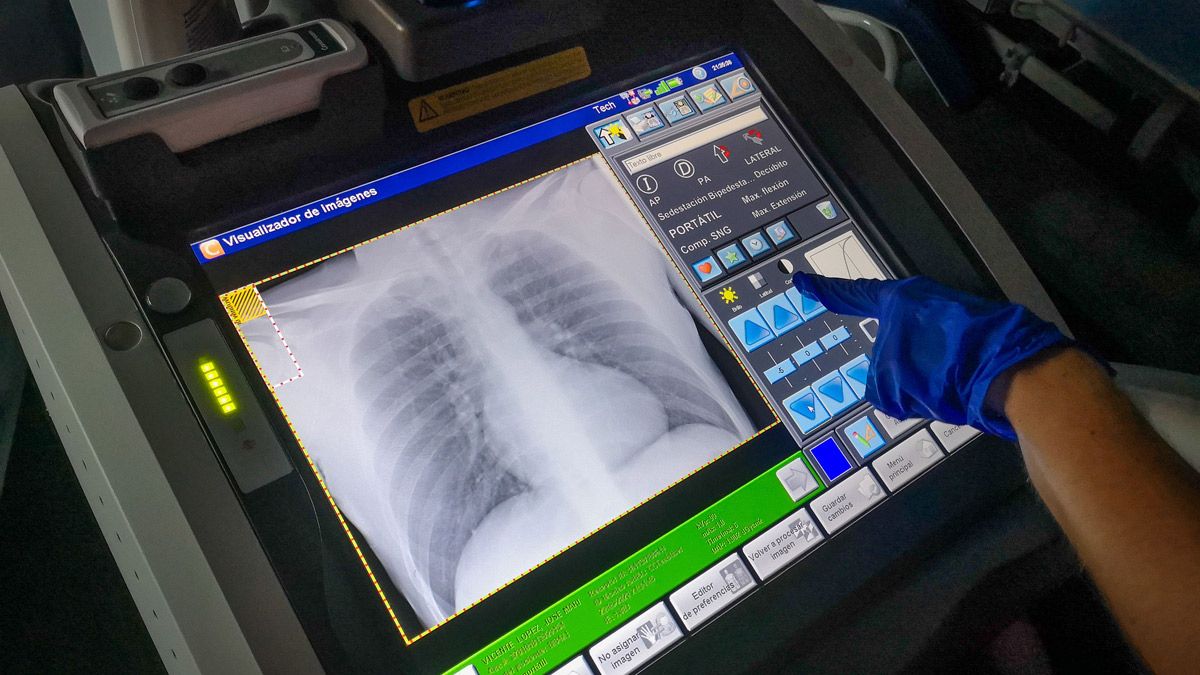 radiografia-pulmones-archivo-30082022.jpg