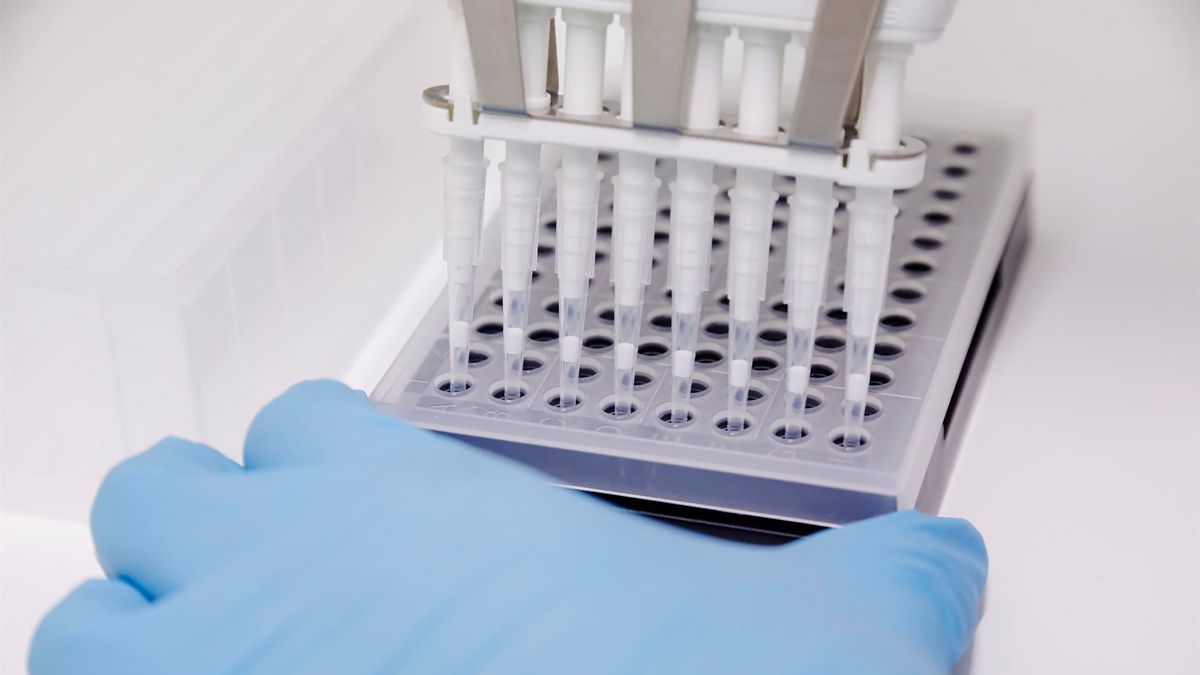 Una técnico de laboratorio prepara una PCR para el análisis de la viruela del mono. | EP Una técnico de laboratorio prepara una PCR para el análisis de la viruela del mono. | EP