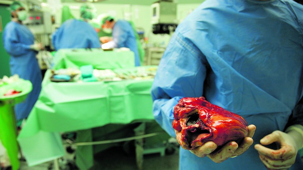Trasplante de corazón en el Hospital Clínico de Valladolid. | EDUARDO MARGARETO (ICAL)