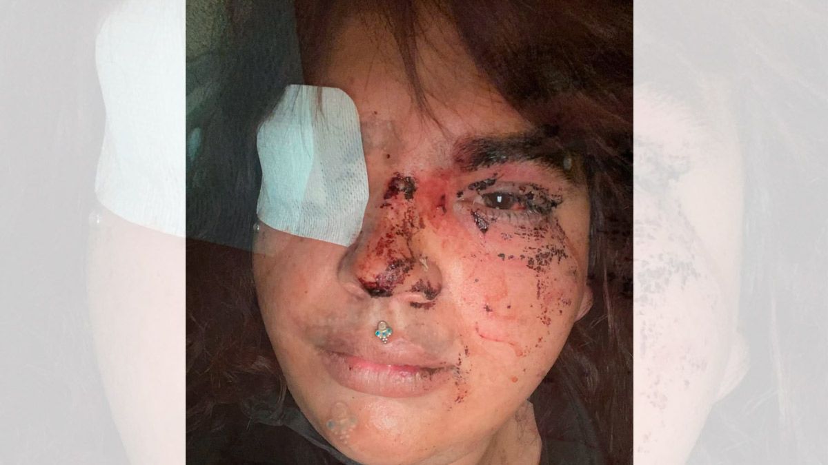 Imagen que Bianca Lizbeth Fernández, Miss Trans Zamora 2024, ha subido a redes sociales denunciado la agresión.