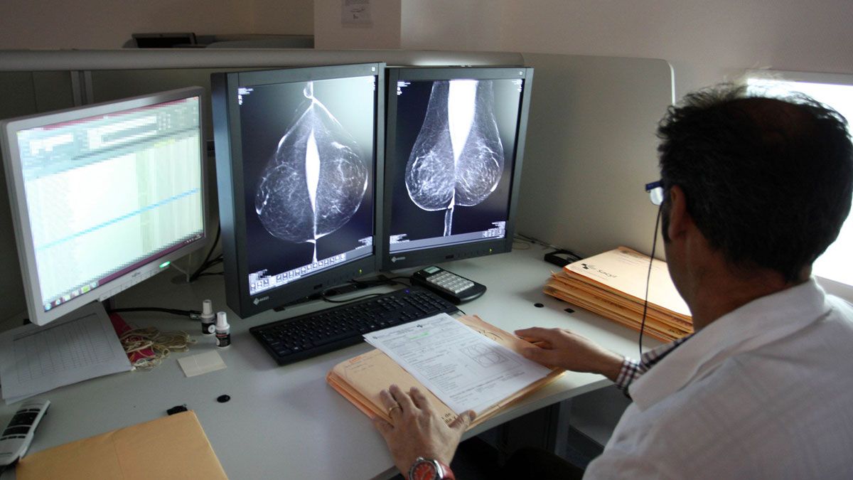 Estudio de una mamografía en un hospital. | ICAL