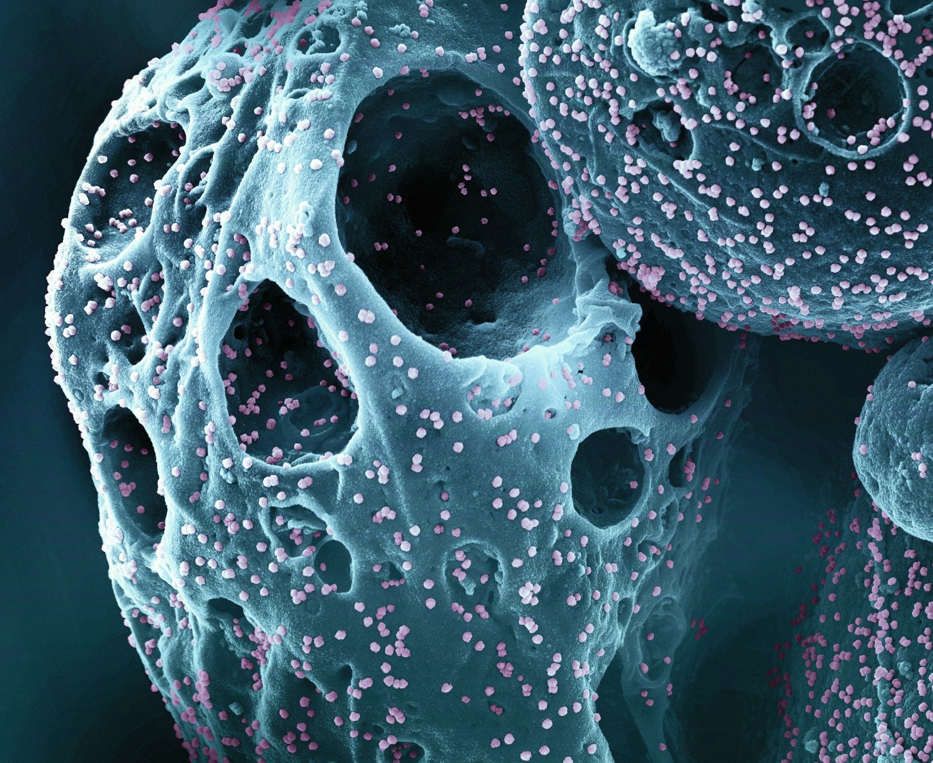 Imagen de células al microscopio electrónico, un ámbito en el que la inteligencia artificial abre nuevas vías en la investigación del cáncer