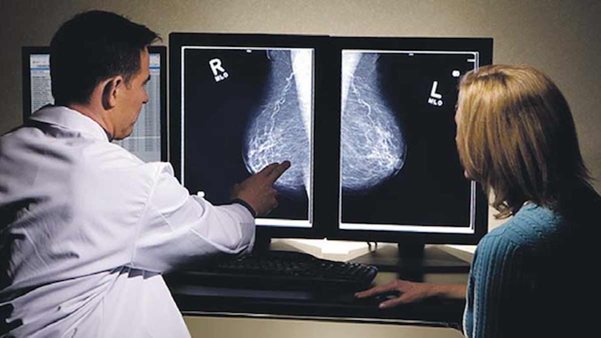 Las mamografías a partir de los 50 años son cruciales en la detección del cáncer de mama. Las mamografías a partir de los 50 años son cruciales en la detección del cáncer de mama.
