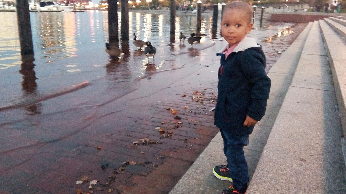 Leo, un bebé segoviano que sufre una enfermedad rara conocida como 'fémur corto congénito', durante su estancia en EEUU. | ICAL