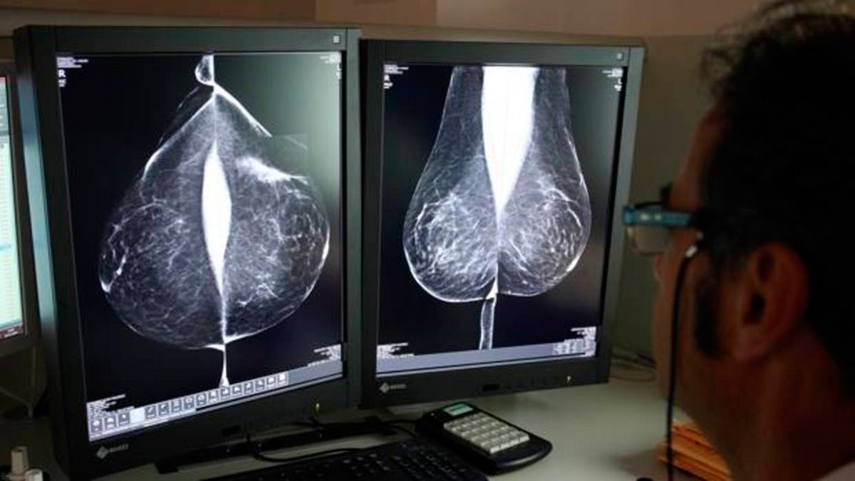 mamografia-abc-15218.jpg