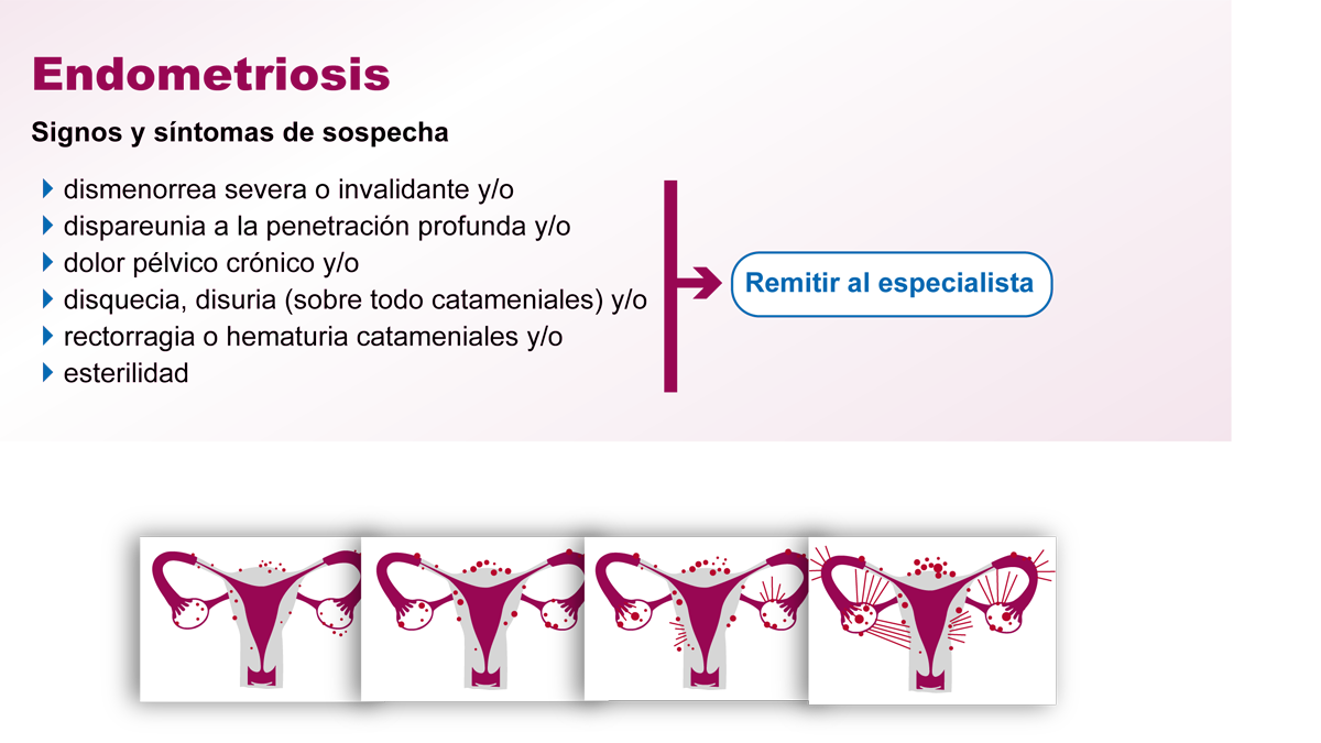 Parte del díptico elaborado por el Servicio Nacional de Salud para la detección precoz y abordaje de la endometriosis. | L.N.C.